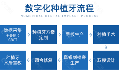 上海华美口腔医院数字化种植牙流程图