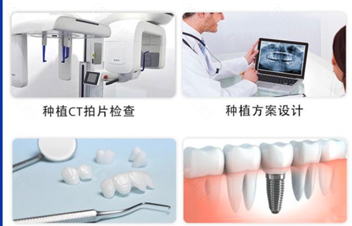 烟台口腔医院种植牙